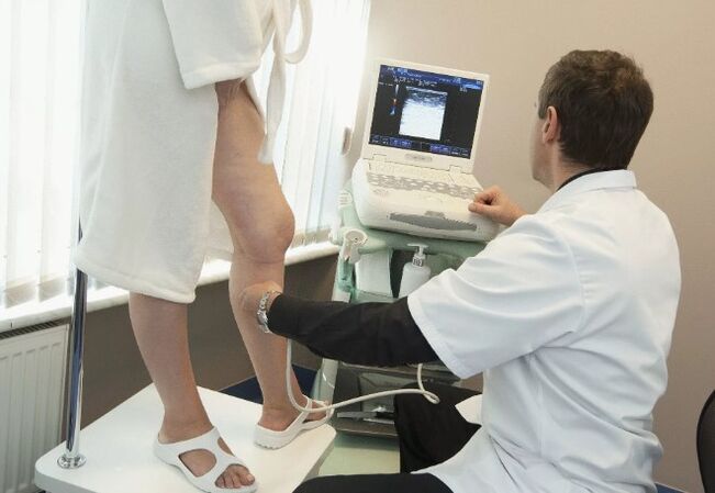 Diagnoza krčnih žil
